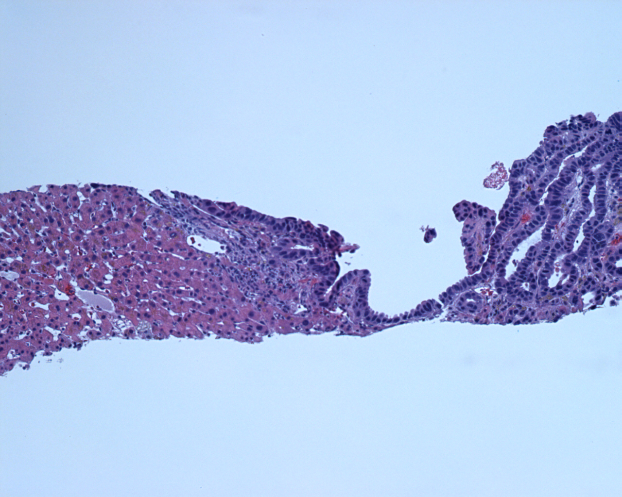 Pathology Image